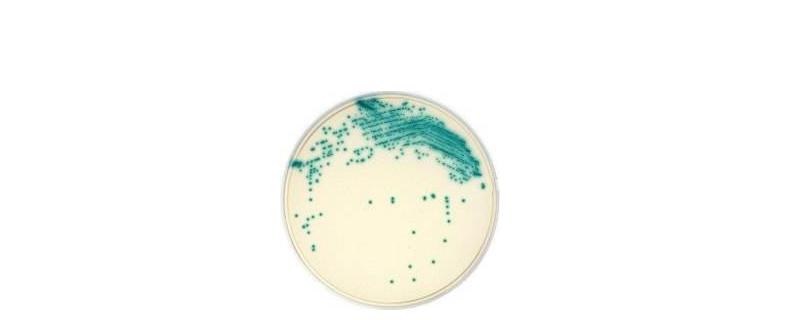 微生物培养基质有哪些种类