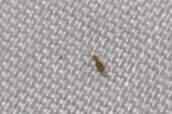 猫绦虫严重吗，比较严重但通常无特征性临床症状