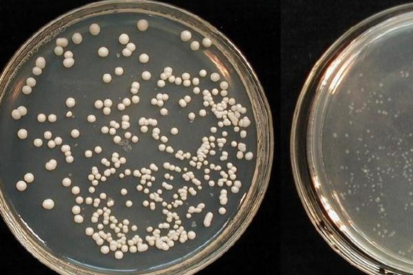 菌种选育的优缺点,可以纯化菌种但工作量大