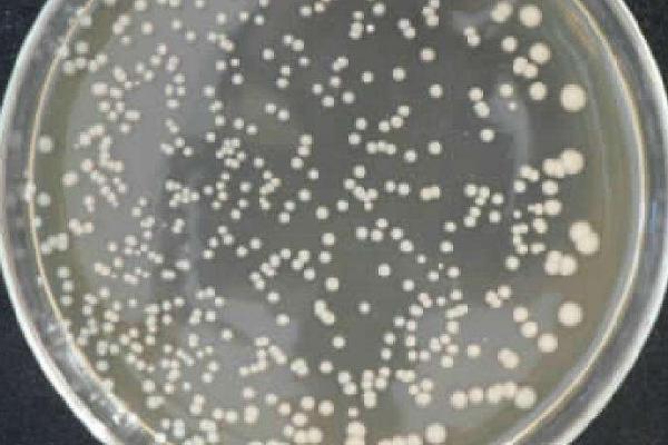 菌种选育的优缺点,可以纯化菌种但工作量大