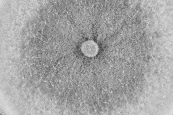 木霉菌如何防治病害,可寄生在病菌上、使其细胞壁破裂